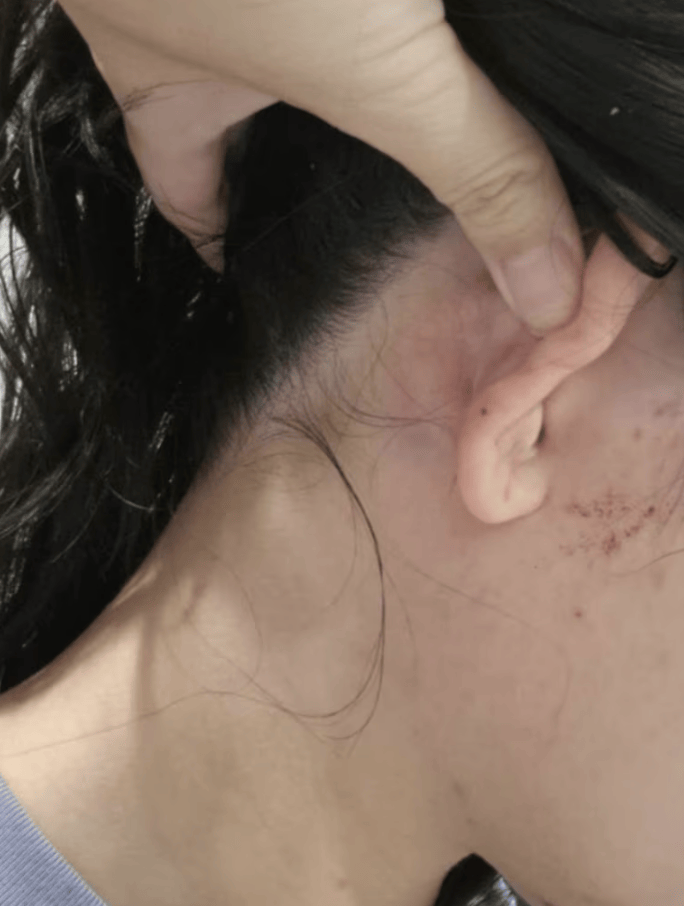 使馆回应中国女子在堪培拉遭陌生人殴打:要求澳警方彻查案件